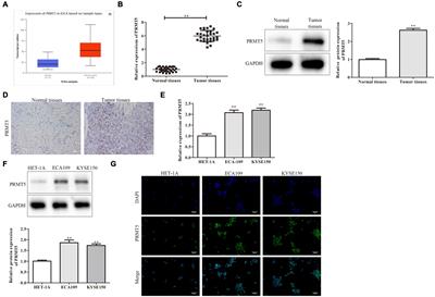 Protein Arginine Methyltransferase 5 Promotes Esophageal Squamous Cell Carcinoma Proliferation and Metastasis via LKB1/AMPK/mTOR Signaling Pathway